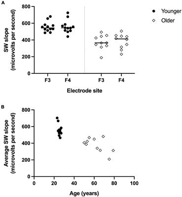 Individual differences in slow wave sleep architecture relate to variation in white matter microstructure across adulthood